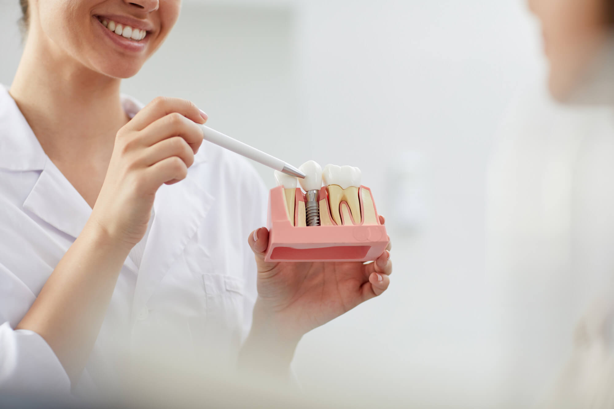 Implant Surgery